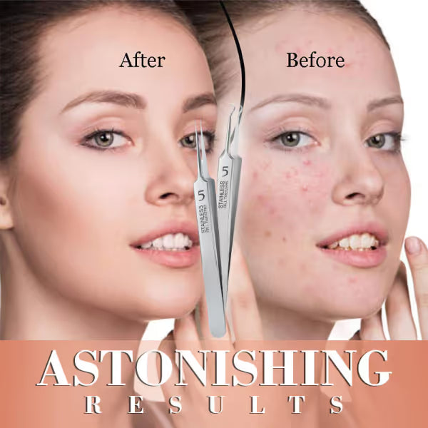 🎆2026 New Year Launch! Professional Salon Tweezers | Precision Slant & Pointed Tips for Brows & Lashes | LIMITED TIME: Get FREE 4Pcs Blackhead Needles Set | Must-Have for MUA & Home Makeup Kits ✨